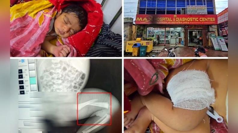 কলাপাড়ায় হাসপাতালে নবজাতকের পা ভাঙার অভিযোগ