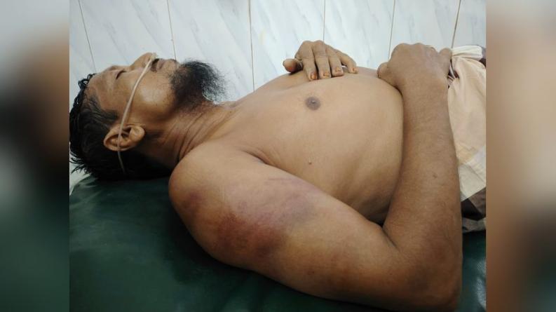 লালমোহনে জমি বিরোধে মারধরের অভিযোগ, হাসপাতালে একজন