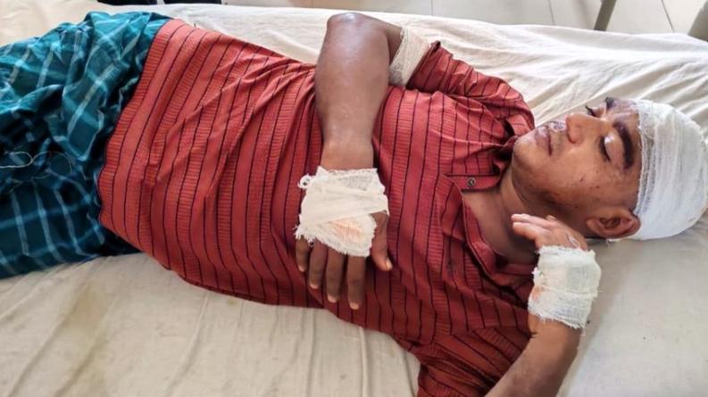 কাউখালীতে বিএনপি নেতা সরোয়ারকে পিটিয়ে আহত, গ্রেপ্তার ১